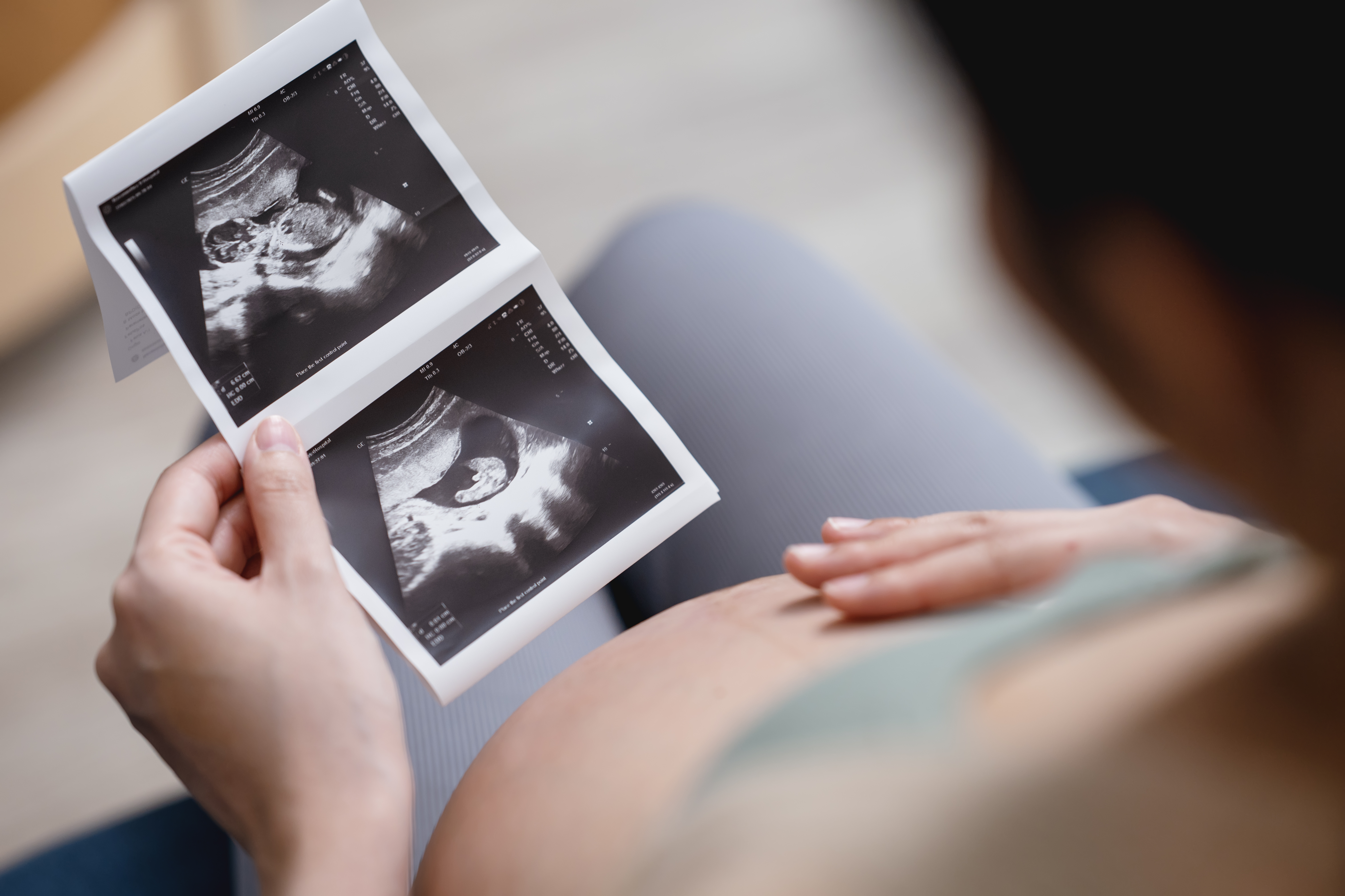 Gravid kvinna sitter ner och tittar på en ultraljudsbild av sin bebis