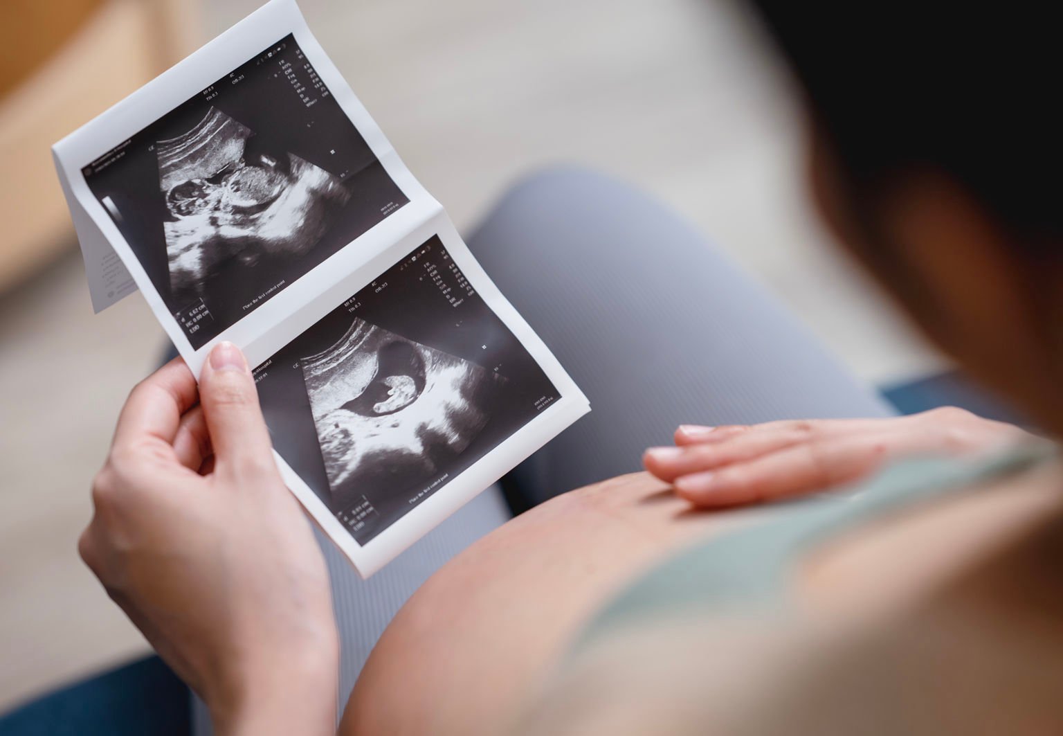 Gravid kvinna sitter ner och tittar på en ultraljudsbild av sin bebis