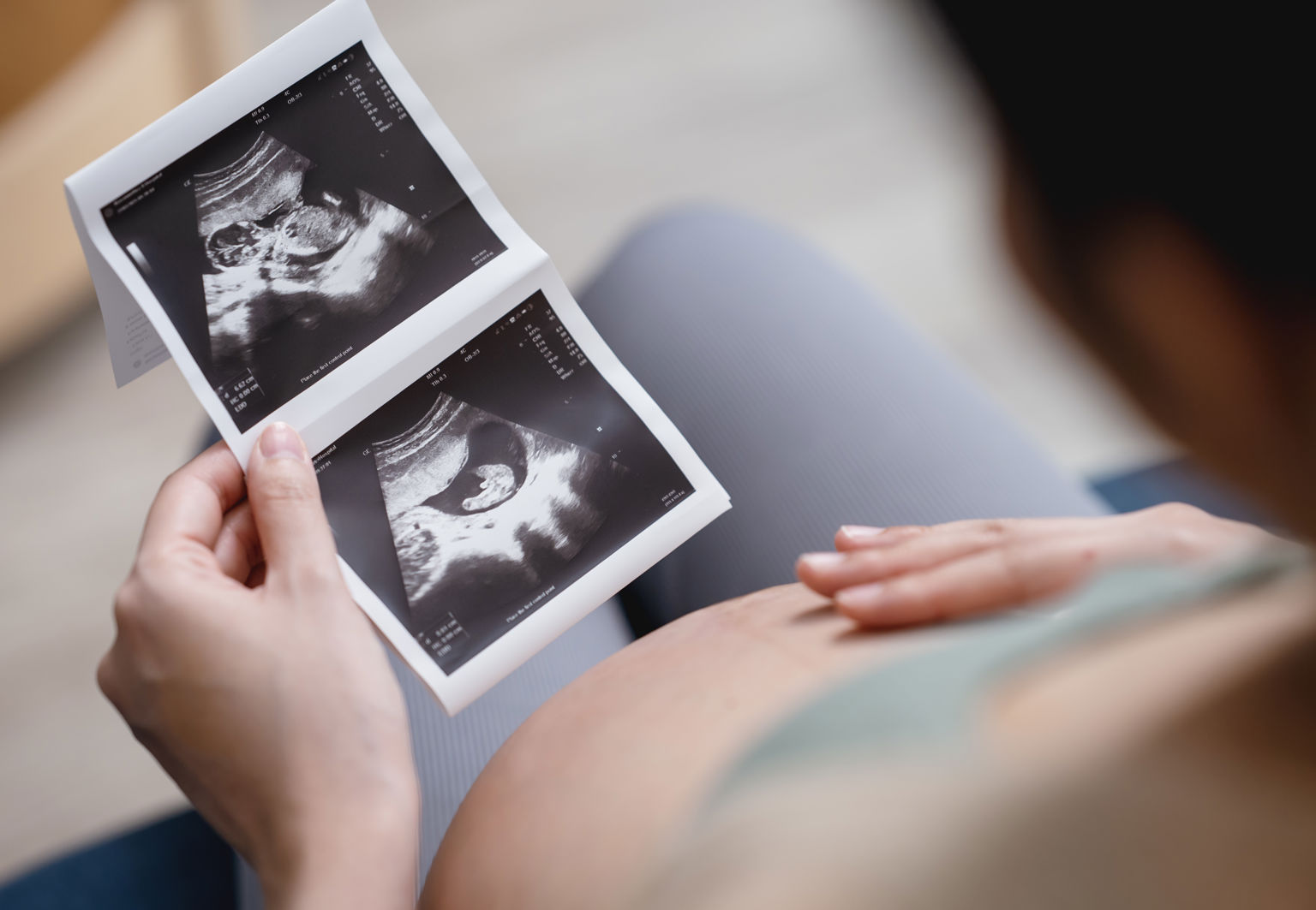 Gravid kvinna sitter ner och tittar på en ultraljudsbild av sin bebis